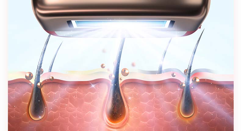 Step by step: how to use IPL device at home?