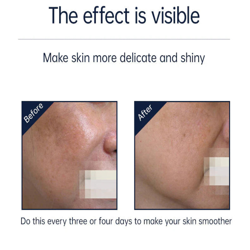 MLAY RF02 Beauty Device