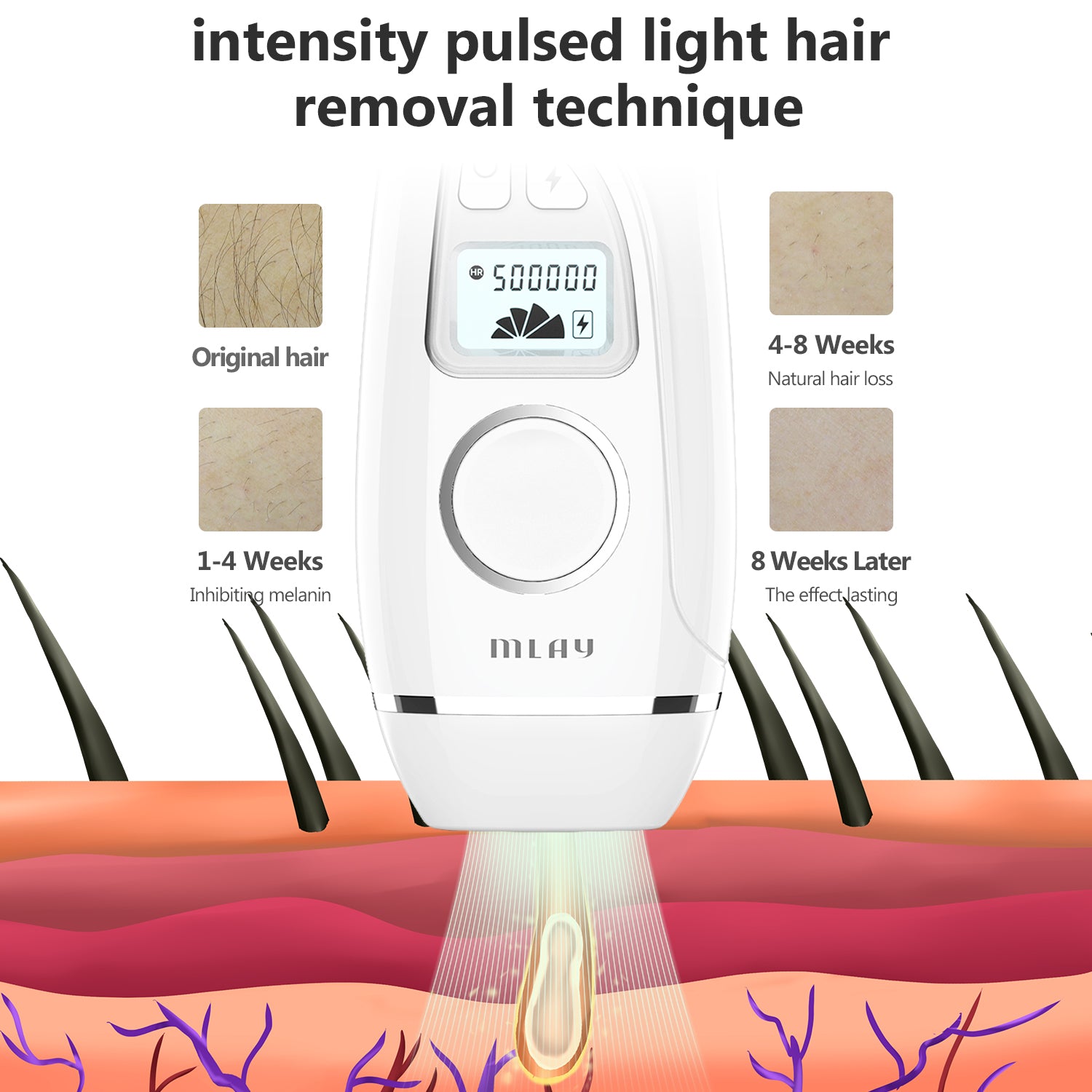 MLAY T7 IPL Hair Removal Device