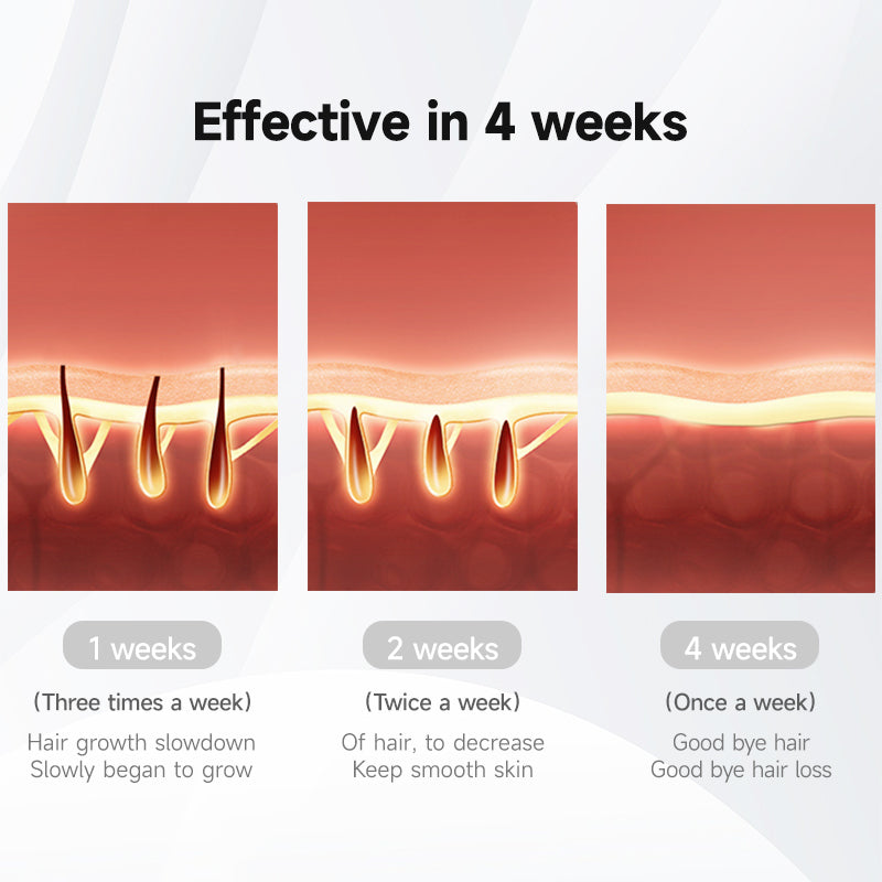 MLAY T5 IPL Hair Removal Device