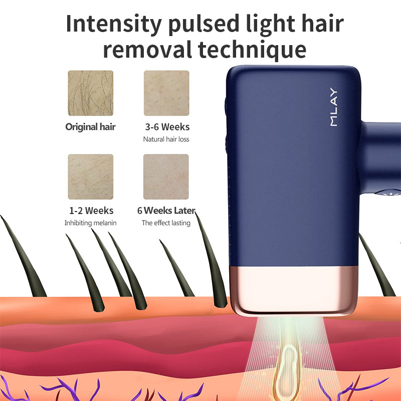 MLAY T14 IPL Hair Removal Device