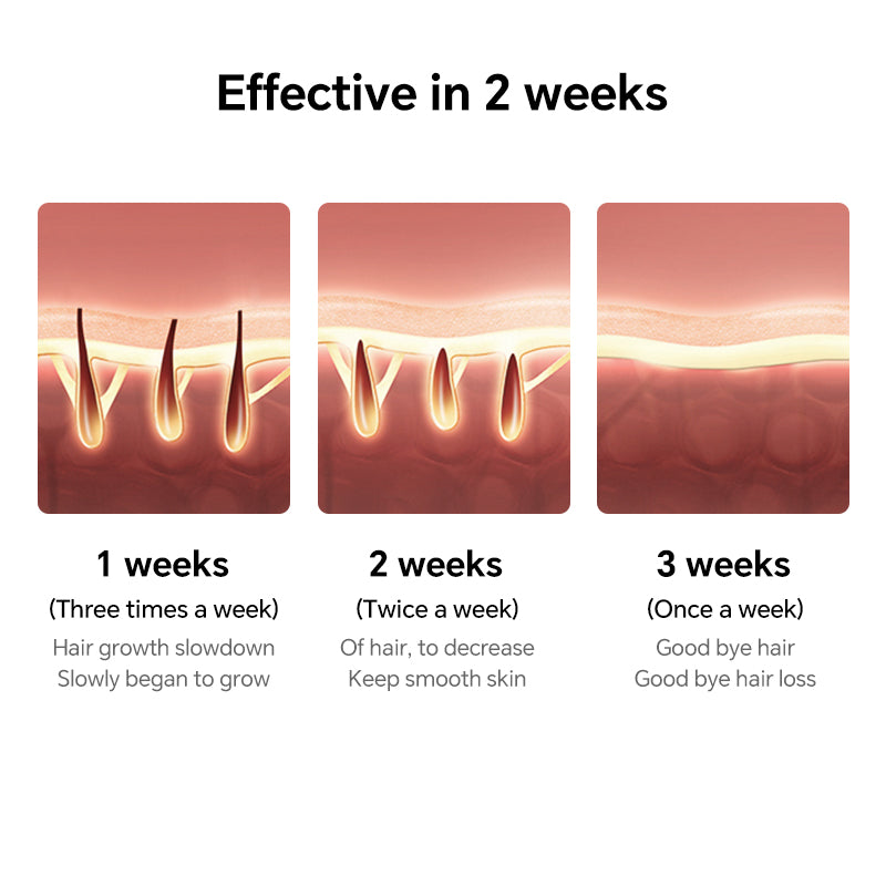 MLAY T1/M3 IPL Hair Removal Device