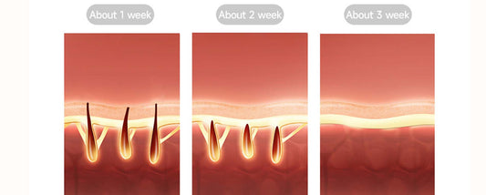 7 benefits of using IPL at home