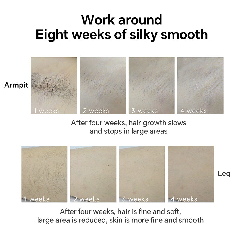 MLAY T5 IPL Hair Removal Device