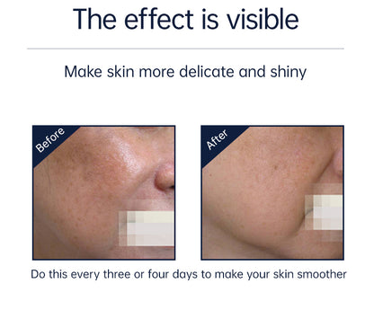 Mlay Immortal Beauty RF + EMS Anti-Cellulite Beauty Device RF02